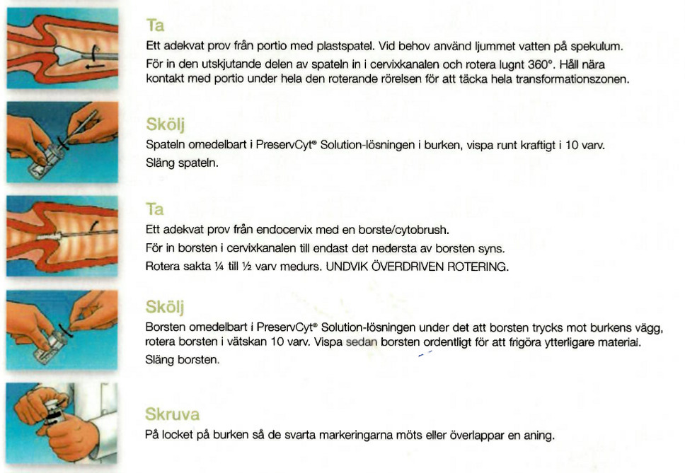 Instruktion provtagning cervixcytologi