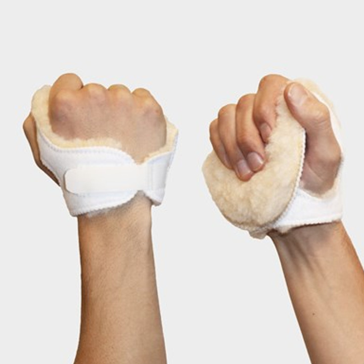 En hand med handflatsskydd
