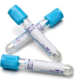 Produkt Vakuumrör koagulation, ljusblå, 5/2,7ml med Na-citrat